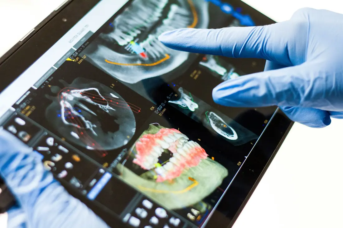 Digital implant planning on a tablet during a hands-on session