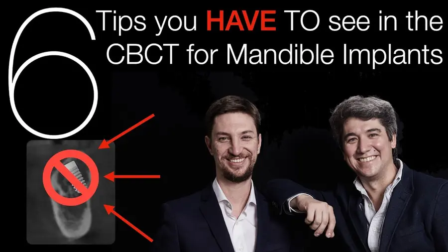 Still from the video «Immediate implant: the nerve, and enough bone? Six tips on the CBCT»